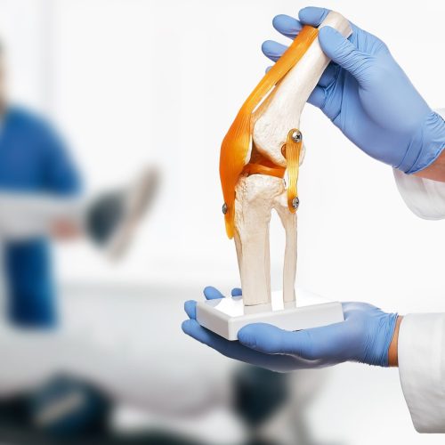 Physiotherapist holds an anatomical human knee-joint model in his hands, over background physiotherapy session for an elderly patient. Concept physio treatment and kinesiotherapy